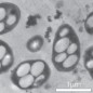 bacteria-wolfesimon3HR
